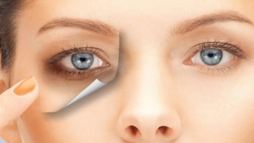 كيفية التخلص من الهالات السوداء تحت العين باستخدام "عرق السوس"