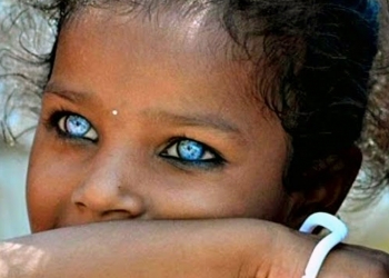 أسباب اختلاف ألوان العيون.. وما هو اللون الأكثر شيوعاً في العالم؟