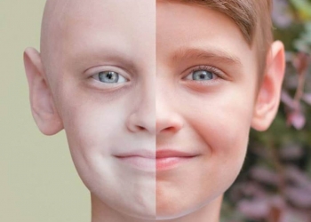لن تصدّق من هم الأشخاص الأكثر عرضة للإصابة بالسرطان.. لا تتجاهل الأمر