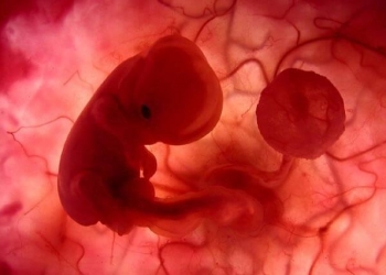 تنظيف الرحم بعد الإجهاض.. إليكِ هذه العناصر الطبيعية المفيدة