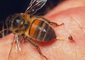 العلاج بسم النحل
