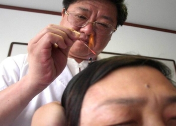 طبيبة توضح أن "الإبر الصينية" لم تثبت فعاليتها علمياً